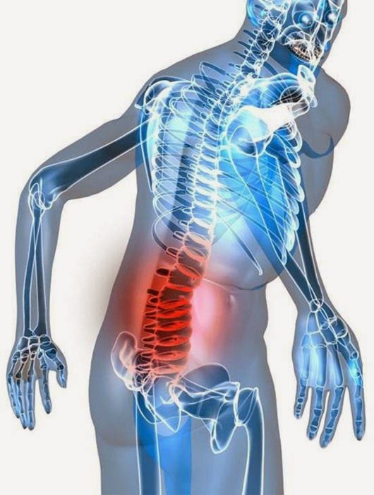 Páteř, bolesti páteře, bolesti zad - byliny, bylinky, babské rady, obklady