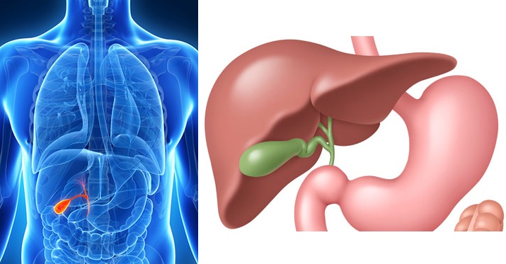 Žlučník, žlučníkový záchvat, křeče, zánět žlučníku, kaménky - byliny, bylinky, babské rady, čaj, tinkutra, obklad